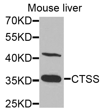 CTSS / Cathepsin S Antibody - Western blot analysis of extracts of various cells.
