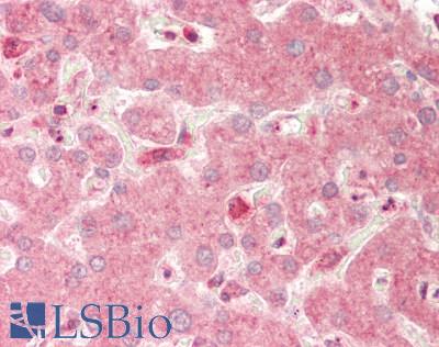 CTSS / Cathepsin S Antibody - Human Liver: Formalin-Fixed, Paraffin-Embedded (FFPE).  This image was taken for the unconjugated form of this product. Other forms have not been tested.