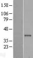 CTSS / Cathepsin S Protein - Western validation with an anti-DDK antibody * L: Control HEK293 lysate R: Over-expression lysate