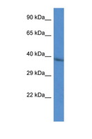 CTSV / Cathepsin V Antibody - CTSL2 / Cathepsin V antibody Western blot of HepG2 Cell lysate. Antibody concentration 1 ug/ml.  This image was taken for the unconjugated form of this product. Other forms have not been tested.