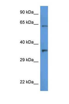 CTSV / Cathepsin V Antibody - CTSL2 / Cathepsin V antibody Western blot of HT1080 Cell lysate. Antibody concentration 1 ug/ml.  This image was taken for the unconjugated form of this product. Other forms have not been tested.