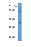 CTSV / Cathepsin V Antibody - CTSL2 / Cathepsin V antibody Western blot of HT1080 Cell lysate. Antibody concentration 1 ug/ml.  This image was taken for the unconjugated form of this product. Other forms have not been tested.
