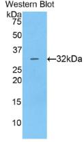 CTSV / Cathepsin V Antibody - Western Blot; Sample: Recombinant protein.