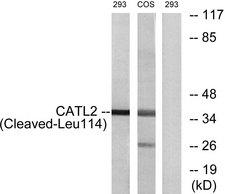 CTSV / Cathepsin V Antibody - Western blot analysis of extracts from 293 cells and COS-7 cells treated with etoposide (25uM, 1hour), and HeLa cells treated with etoposide (25uM, 24hours), using CATL2 (Cleaved-Leu114) antibody.