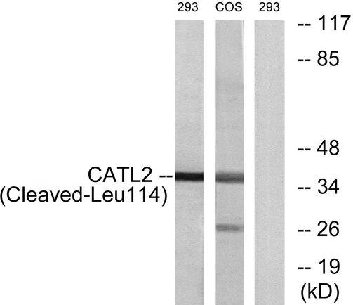 CTSV / Cathepsin V Antibody - Western blot analysis of extracts from 293 cells and COS-7 cells treated with etoposide (25uM, 1hour), and HeLa cells treated with etoposide (25uM, 24hours), using CATL2 (Cleaved-Leu114) antibody.