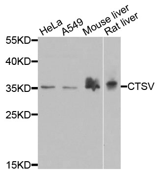 CTSV / Cathepsin V Antibody - Western blot analysis of extracts of various cells.