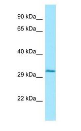 CTSW / Cathepsin W Antibody - CTSW / Cathepsin W antibody Western Blot of HepG2.  This image was taken for the unconjugated form of this product. Other forms have not been tested.