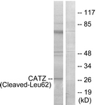 CTSZ / Cathepsin Z Antibody - Western blot of extracts from COS7 cells, treated with etoposide 25 uM 1h, using CATZ (Cleaved-Leu62) Antibody. The lane on the right is treated with the synthesized peptide.