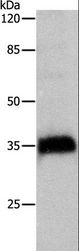 CTSZ / Cathepsin Z Antibody - Western blot analysis of HeLa cell, using CTSZ Polyclonal Antibody at dilution of 1:500.