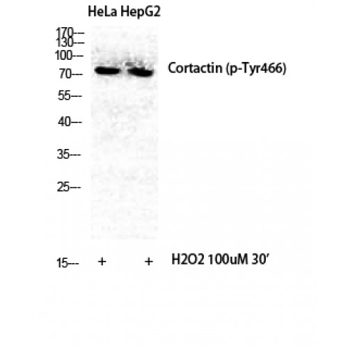 CTTN / Cortactin Antibody - Western blot of Phospho-Cortactin (Y466) antibody