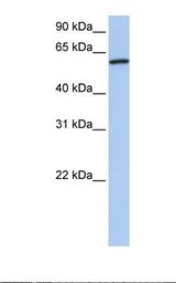CTTN / Cortactin Antibody - Fetal brain lysate. Antibody concentration: 1.0 ug/ml. Gel concentration: 12%.  This image was taken for the unconjugated form of this product. Other forms have not been tested.