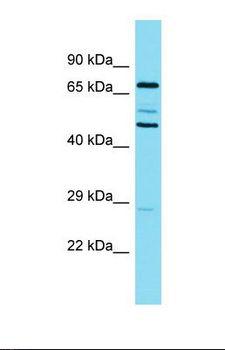 CTTN / Cortactin Antibody - Western blot of Human Lymph Node Tumor. CTTN antibody dilution 1.0 ug/ml.  This image was taken for the unconjugated form of this product. Other forms have not been tested.