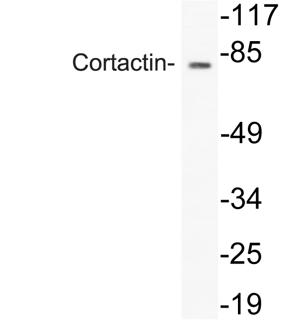 CTTN / Cortactin Antibody - Western blot analysis of lysate from HeLa cells, using Cortactin antibody.