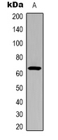 CTTN / Cortactin Antibody - Western blot analysis of Cortactin (AcK235) expression in HepG2 UV-treated (A) whole cell lysates.