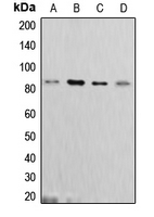 CTTN / Cortactin Antibody - Western blot analysis of Cortactin expression in MCF7 (A); C6 (B); A431 (C); HeLa (D) whole cell lysates.