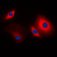 CTTN / Cortactin Antibody - Immunofluorescent analysis of Cortactin staining in MCF7 cells. Formalin-fixed cells were permeabilized with 0.1% Triton X-100 in TBS for 5-10 minutes and blocked with 3% BSA-PBS for 30 minutes at room temperature. Cells were probed with the primary antibody in 3% BSA-PBS and incubated overnight at 4 C in a humidified chamber. Cells were washed with PBST and incubated with a DyLight 594-conjugated secondary antibody (red) in PBS at room temperature in the dark. DAPI was used to stain the cell nuclei (blue).