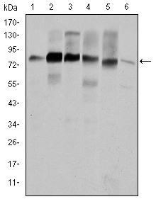 CTTN / Cortactin Antibody - Western blot using CTTN mouse monoclonal antibody against HeLa (1), A431 (2), MCF-7 (3), SR-BR-3 (4), HepG2 (5) and NIH/3T3 (6) cell lysate.