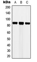 CTTN / Cortactin Antibody - Western blot analysis of Cortactin expression in MCF7 (A); HeLa (B); NIH3T3 (C) whole cell lysates.