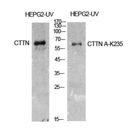 CTTN / Cortactin Antibody - Western blot of Acetyl-Cortactin (K235) antibody