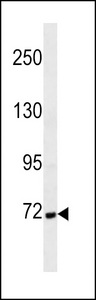 CTTN / Cortactin Antibody - Cortactin Antibody western blot of MDA-MB231 cell line lysates (35 ug/lane). The Cortactin antibody detected the Cortactin protein (arrow).