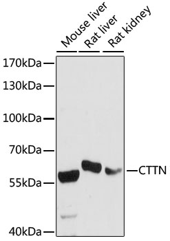 CTTN / Cortactin Antibody - Western blot analysis of extracts of various cell lines, using CTTN antibody at 1:1000 dilution. The secondary antibody used was an HRP Goat Anti-Rabbit IgG (H+L) at 1:10000 dilution. Lysates were loaded 25ug per lane and 3% nonfat dry milk in TBST was used for blocking. An ECL Kit was used for detection and the exposure time was 60s.
