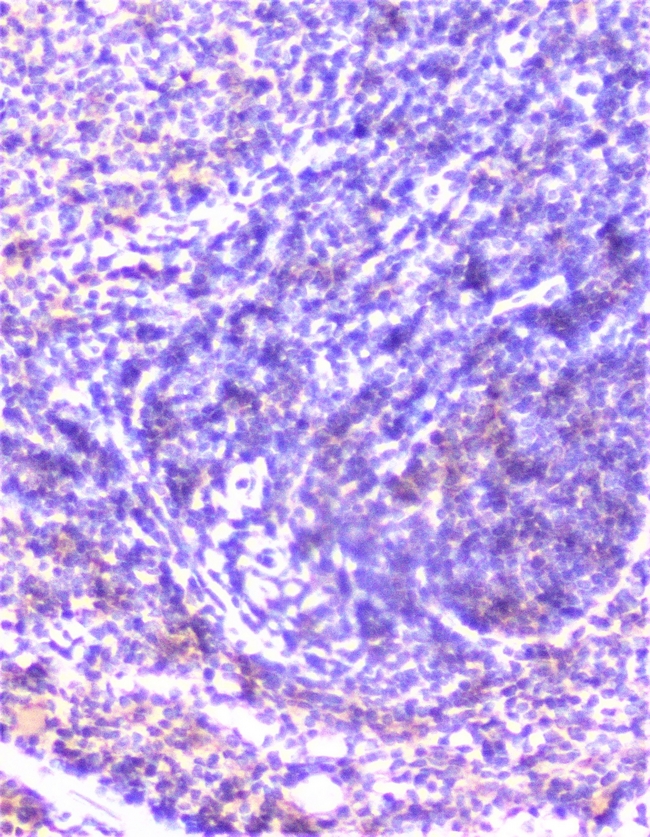 CTTN / Cortactin Antibody - IHC analysis of cortactin using anti-cortactin antibody. cortactin was detected in paraffin-embedded section of mouse spleen tissue. Heat mediated antigen retrieval was performed in citrate buffer (pH6, epitope retrieval solution) for 20 mins. The tissue section was blocked with 10% goat serum. The tissue section was then incubated with 1µg/ml rabbit anti-cortactin Antibody overnight at 4°C. Biotinylated goat anti-rabbit IgG was used as secondary antibody and incubated for 30 minutes at 37°C. The tissue section was developed using Strepavidin-Biotin-Complex (SABC) with DAB as the chromogen.