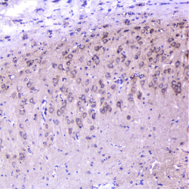 CTTN / Cortactin Antibody - IHC analysis of cortactin using anti-cortactin antibody. cortactin was detected in paraffin-embedded section of rat brain tissue. Heat mediated antigen retrieval was performed in citrate buffer (pH6, epitope retrieval solution) for 20 mins. The tissue section was blocked with 10% goat serum. The tissue section was then incubated with 1µg/ml rabbit anti-cortactin Antibody overnight at 4°C. Biotinylated goat anti-rabbit IgG was used as secondary antibody and incubated for 30 minutes at 37°C. The tissue section was developed using Strepavidin-Biotin-Complex (SABC) with DAB as the chromogen.