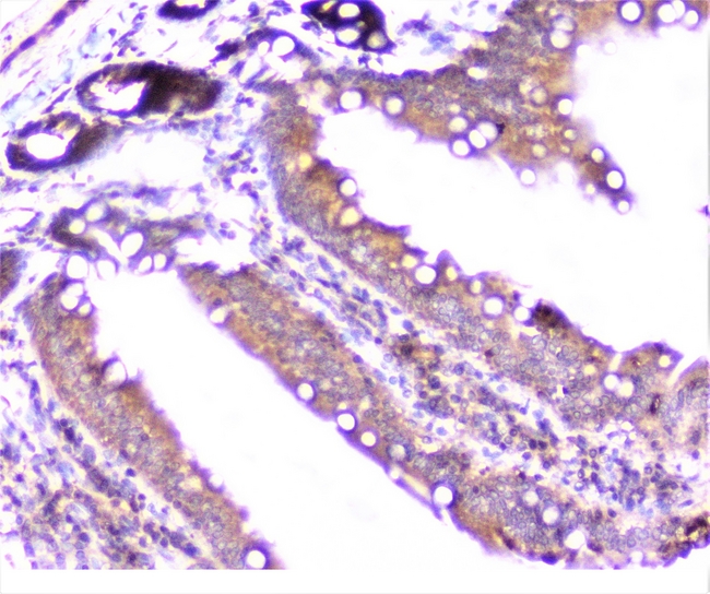 CTTN / Cortactin Antibody - IHC analysis of cortactin using anti-cortactin antibody. cortactin was detected in paraffin-embedded section of rat intestine tissue. Heat mediated antigen retrieval was performed in citrate buffer (pH6, epitope retrieval solution) for 20 mins. The tissue section was blocked with 10% goat serum. The tissue section was then incubated with 1µg/ml rabbit anti-cortactin Antibody overnight at 4°C. Biotinylated goat anti-rabbit IgG was used as secondary antibody and incubated for 30 minutes at 37°C. The tissue section was developed using Strepavidin-Biotin-Complex (SABC) with DAB as the chromogen.