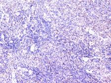 CTTN / Cortactin Antibody - IHC analysis of cortactin using anti-cortactin antibody. cortactin was detected in paraffin-embedded section of rat spleen tissue. Heat mediated antigen retrieval was performed in citrate buffer (pH6, epitope retrieval solution) for 20 mins. The tissue section was blocked with 10% goat serum. The tissue section was then incubated with 1µg/ml rabbit anti-cortactin Antibody overnight at 4°C. Biotinylated goat anti-rabbit IgG was used as secondary antibody and incubated for 30 minutes at 37°C. The tissue section was developed using Strepavidin-Biotin-Complex (SABC) with DAB as the chromogen.