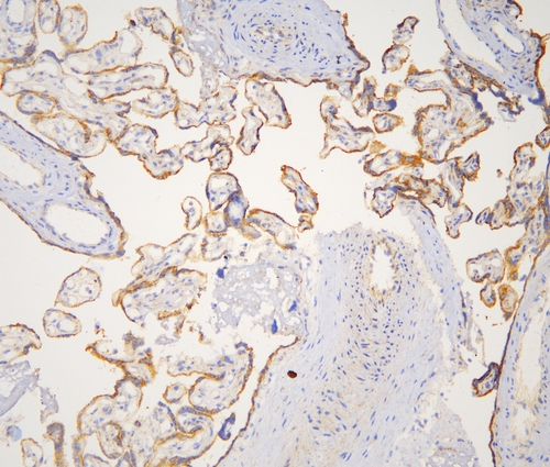 CTTN / Cortactin Antibody - IHC analysis of cortactin using anti-cortactin antibody. cortactin was detected in frozen section of human placenta tissues. Heat mediated antigen retrieval was performed in citrate buffer (pH6, epitope retrieval solution) for 20 mins. The tissue section was blocked with 10% goat serum. The tissue section was then incubated with 1µg/ml rabbit anti-cortactin Antibody overnight at 4°C. Biotinylated goat anti-rabbit IgG was used as secondary antibody and incubated for 30 minutes at 37°C. The tissue section was developed using Strepavidin-Biotin-Complex (SABC) with DAB as the chromogen.