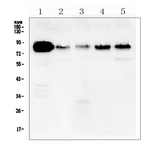 CTTN / Cortactin Antibody - Western blot analysis of cortactin using anti-cortactin antibody. Electrophoresis was performed on a 5-20% SDS-PAGE gel at 70V (Stacking gel) / 90V (Resolving gel) for 2-3 hours. The sample well of each lane was loaded with 50ug of sample under reducing conditions. Lane 1: human A431 whole cell lysate,Lane 2: human U-87MG whole cell lysate,Lane 3: human A549 whole cell lysate,Lane 4: human PC-3 whole cell lysate,Lane 5: human Hela whole cell lysate. After Electrophoresis, proteins were transferred to a Nitrocellulose membrane at 150mA for 50-90 minutes. Blocked the membrane with 5% Non-fat Milk/ TBS for 1.5 hour at RT. The membrane was incubated with rabbit anti-cortactin antigen affinity purified polyclonal antibody at 0.5 µg/mL overnight at 4°C, then washed with TBS-0.1% Tween 3 times with 5 minutes each and probed with a goat anti-rabbit IgG-HRP secondary antibody at a dilution of 1:10000 for 1.5 hour at RT. The signal is developed using an Enhanced Chemiluminescent detection (ECL) kit with Tanon 5200 system. A specific band was detected for cortactin at approximately 85KD. The expected band size for cortactin is at 61KD.