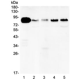 CTTN / Cortactin Antibody - Western blot testing of human 1) A431, 2) U-87 MG, 3) A549, 4) PC-3 and 5) HeLa lysate with Cortactin antibody at 0.5ug/ml. Predicted molecular weight ~61 kDa but routinely observed at ~80 kDa.