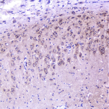 CTTN / Cortactin Antibody - IHC staining of FFPE rat brain with Cortactin antibody at 1ug/ml. HIER: boil tissue sections in pH6, 10mM citrate buffer, for 10-20 min followed by cooling at RT for 20 min.