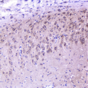 CTTN / Cortactin Antibody - IHC staining of FFPE rat brain with Cortactin antibody at 1ug/ml. HIER: boil tissue sections in pH6, 10mM citrate buffer, for 10-20 min followed by cooling at RT for 20 min.