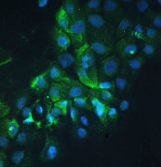 CTTN / Cortactin Antibody - IF/ICC staining of FFPE human A431 cells with Cortactin antibody at 1ug/ml. HIER: boil tissue sections in pH6, 10mM citrate buffer, for 10-20 min followed by cooling at RT for 20 min.