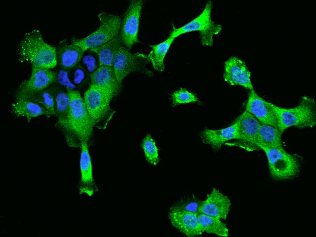 CTTN / Cortactin Antibody - Immunofluorescence staining of CTTN in A431 cells. Cells were fixed with 4% PFA, permeabilzed with 0.1% Triton X-100 in PBS, blocked with 10% serum, and incubated with rabbit anti-Human CTTN polyclonal antibody (dilution ratio 1:200) at 4°C overnight. Then cells were stained with the Alexa Fluor 488-conjugated Goat Anti-rabbit IgG secondary antibody (green) and counterstained with DAPI (blue). Positive staining was localized to Cytoplasm and cell membrane.