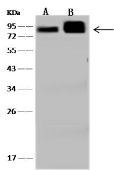 CTTN / Cortactin Antibody - Anti-CTTN rabbit polyclonal antibody at 1:500 dilution. Lane A: U-251MG Whole Cell Lysate. Lane B: HeLa Whole Cell Lysate. Lysates/proteins at 30 ug per lane. Secondary: Goat Anti-Rabbit IgG (H+L)/HRP at 1/10000 dilution. Developed using the ECL technique. Performed under reducing conditions. Predicted band size: 62 kDa.