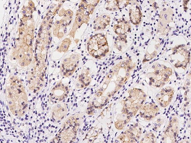 CTTN / Cortactin Antibody - Immunochemical staining of human CTTN in human stomach with rabbit polyclonal antibody at 1:200 dilution, formalin-fixed paraffin embedded sections.