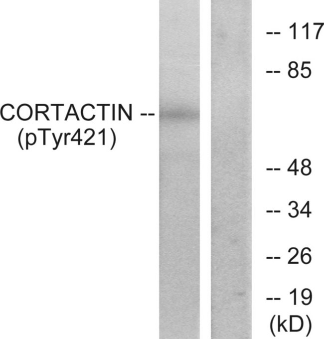 CTTN / Cortactin Antibody - Western blot analysis of lysates from HeLa cells treated with H2O2, using Cortactin (Phospho-Tyr421) Antibody. The lane on the right is blocked with the phospho peptide.