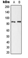 CTTN / Cortactin Antibody - Western blot analysis of Cortactin (pY421) expression in HeLa UV-treated (A); NIH3T3 H2O2-treated (B) whole cell lysates.