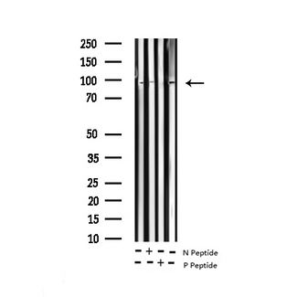 CTTN / Cortactin Antibody - Western blot analysis of Phospho-Cortactin (Tyr421) expression in various lysates