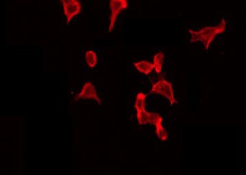 CTTN / Cortactin Antibody - Staining HeLa cells by IF/ICC. The samples were fixed with PFA and permeabilized in 0.1% Triton X-100, then blocked in 10% serum for 45 min at 25°C. The primary antibody was diluted at 1:200 and incubated with the sample for 1 hour at 37°C. An Alexa Fluor 594 conjugated goat anti-rabbit IgG (H+L) Ab, diluted at 1/600, was used as the secondary antibody.