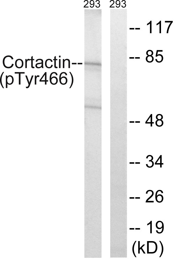CTTN / Cortactin Antibody - Western blot analysis of lysates from 293 cells, using Cortactin (Phospho-Tyr466) Antibody. The lane on the right is blocked with the phospho peptide.