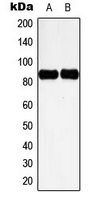 CTTN / Cortactin Antibody - Western blot analysis of Cortactin (pY466) expression in HeLa UV-treated (A); NIH3T3 H2O2-treated (B) whole cell lysates.