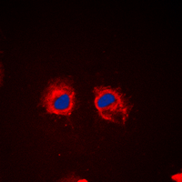 CTTN / Cortactin Antibody - Immunofluorescent analysis of Cortactin (pY466) staining in HeLa cells. Formalin-fixed cells were permeabilized with 0.1% Triton X-100 in TBS for 5-10 minutes and blocked with 3% BSA-PBS for 30 minutes at room temperature. Cells were probed with the primary antibody in 3% BSA-PBS and incubated overnight at 4 C in a humidified chamber. Cells were washed with PBST and incubated with a DyLight 594-conjugated secondary antibody (red) in PBS at room temperature in the dark. DAPI was used to stain the cell nuclei (blue).