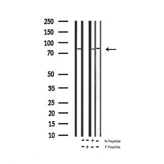 CTTN / Cortactin Antibody - Western blot analysis of Phospho-Cortactin (Tyr466) expression in various lysates