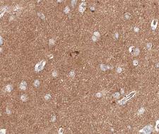 CTTN / Cortactin Antibody - 1:200 staining human brain tissue by IHC-P. The tissue was formaldehyde fixed and a heat mediated antigen retrieval step in citrate buffer was performed. The tissue was then blocked and incubated with the antibody for 1.5 hours at 22°C. An HRP conjugated goat anti-rabbit antibody was used as the secondary.