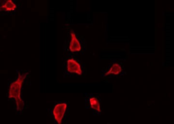 CTTN / Cortactin Antibody - Staining HeLa cells by IF/ICC. The samples were fixed with PFA and permeabilized in 0.1% Triton X-100, then blocked in 10% serum for 45 min at 25°C. The primary antibody was diluted at 1:200 and incubated with the sample for 1 hour at 37°C. An Alexa Fluor 594 conjugated goat anti-rabbit IgG (H+L) Ab, diluted at 1/600, was used as the secondary antibody.