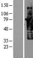 CTTN / Cortactin Protein - Western validation with an anti-DDK antibody * L: Control HEK293 lysate R: Over-expression lysate