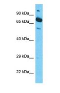 CTTNBP2 Antibody - Western blot of CTTNBP2 Antibody with HepG2 Whole Cell lysate.  This image was taken for the unconjugated form of this product. Other forms have not been tested.